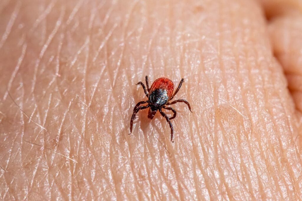 Alpha-Gal Syndrome: The Red Meat Tick Bite Allergy You Didn’t See Coming​